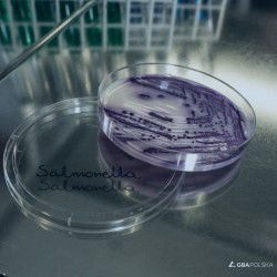 Mikrobiologia 5 powtórzeń
